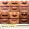 Balsam do ust Sugar Advanced Therapy Kuracja do ust Sugar Advanced Therapy