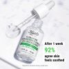 Ultra czyste serum o dużej mocy 5,0% niacynamidu