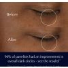 Advanced Night Repair Eye Supercharged Żel-Krem pod oczy w limitowanym słoiczku